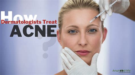 How Does Yale Health Dermatology Treat Acne? Solutions