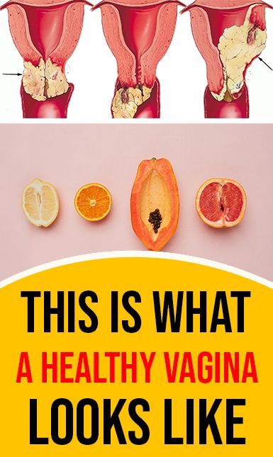 How Healthy Is My Vagina? Check Now