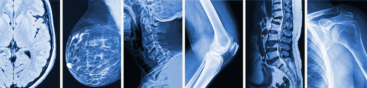 How Long Does Mri On Stomach Take? Quick Answers