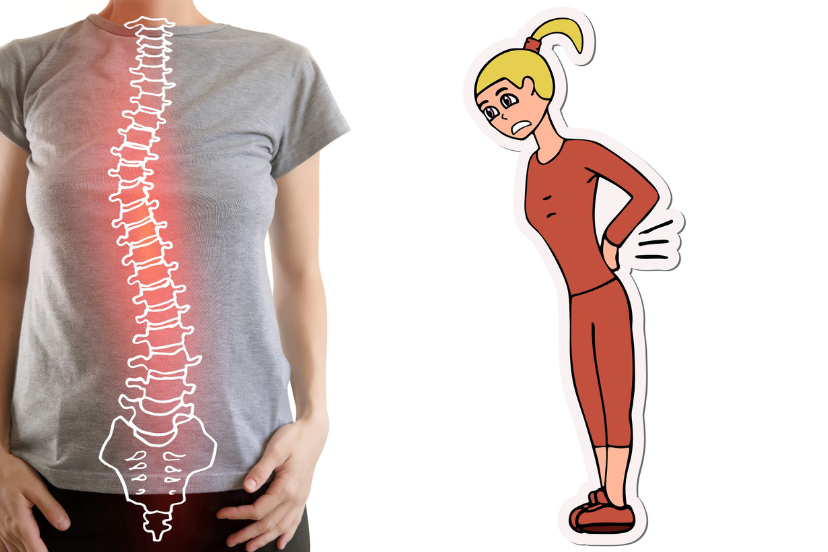 How Long Does Sciatica Last Integrative Pain Spine Institute