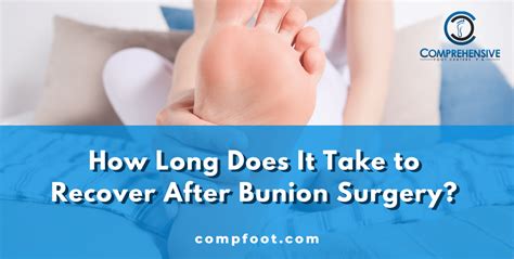 How Long Is Bunion Recovery? Timeline To Healing