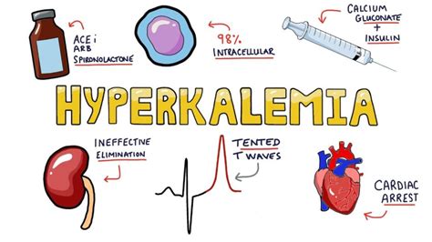 How To Code Hyperkalemia Icd 10? Accurate Billing Tips