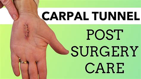 How To Exercise After Carpal Tunnel Surgery With Pictures Carpal