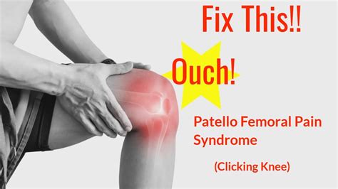 How To Fix Patellofemoral Pain Syndrome Clicking Knee Youtube