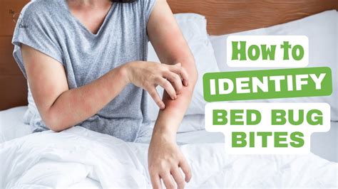 How To Identify Bed Bug Bites And How To Treat Them