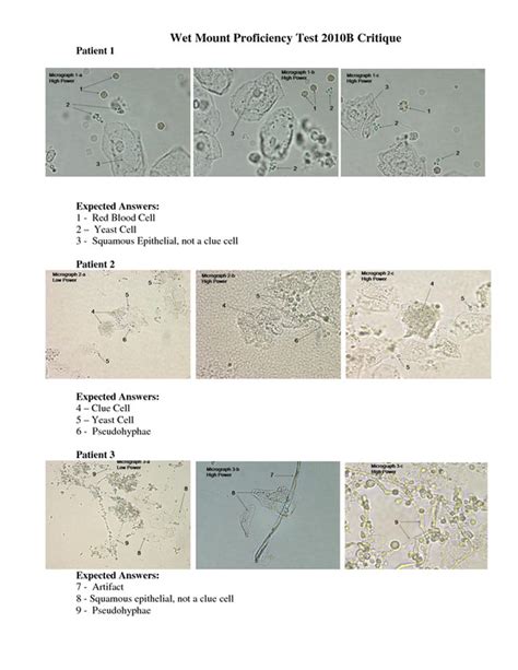 How To Identify Wbcs On Wet Mount? Easy Detection