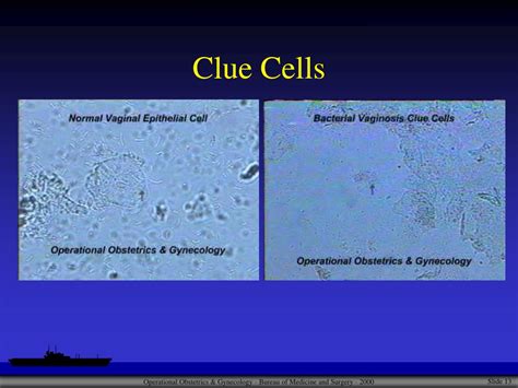 How To Identify Wet Mount Clue Cells? Easy Detection