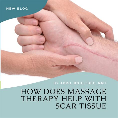 How To Massage A Scar Learn Techniques To Help Reduce Scar Tissue