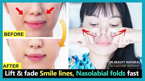 How To Reduce Nasolabial Folds Face Lifting Exercises For Smile Lines