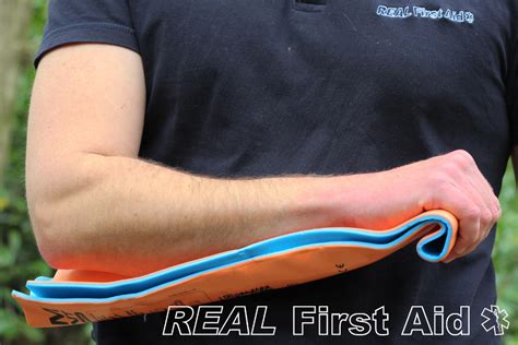 How To Splint An Arm? Easy Injury Fix