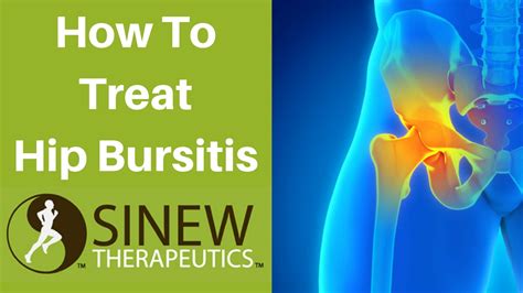 How To Treat Hip Bursitis? Symptom Solutions