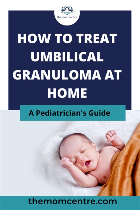 How To Treat Umbilical Granuloma At Home The Mom Centre