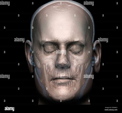 Human Head 3D Ct Scan Stock Photo Alamy