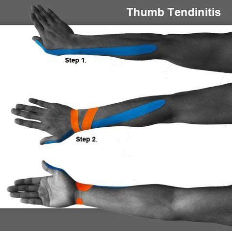 Image Result For K Tape De Quervain S Tenosynovitis Kinesiology