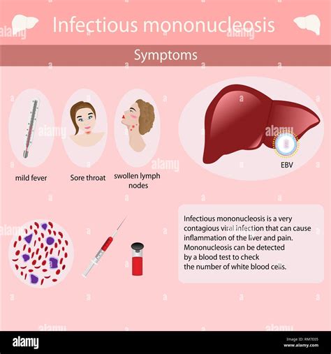 Infectious Mononucleosis Causes Signs And Symptoms Diagnosis And