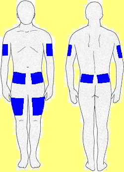 Injection Site For Insulin