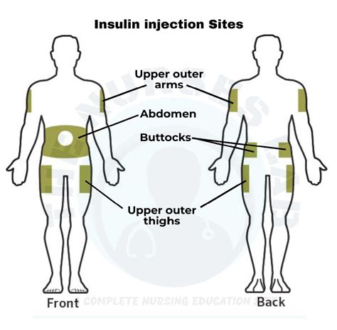 Insulin Sites For Injection