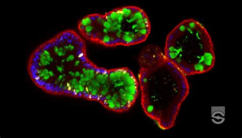 Intestinal Organoid Mini Review