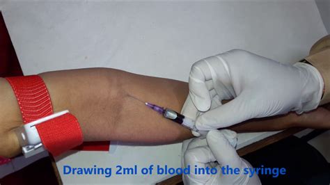 Intra Venous Iv Blood Collection Technique Youtube