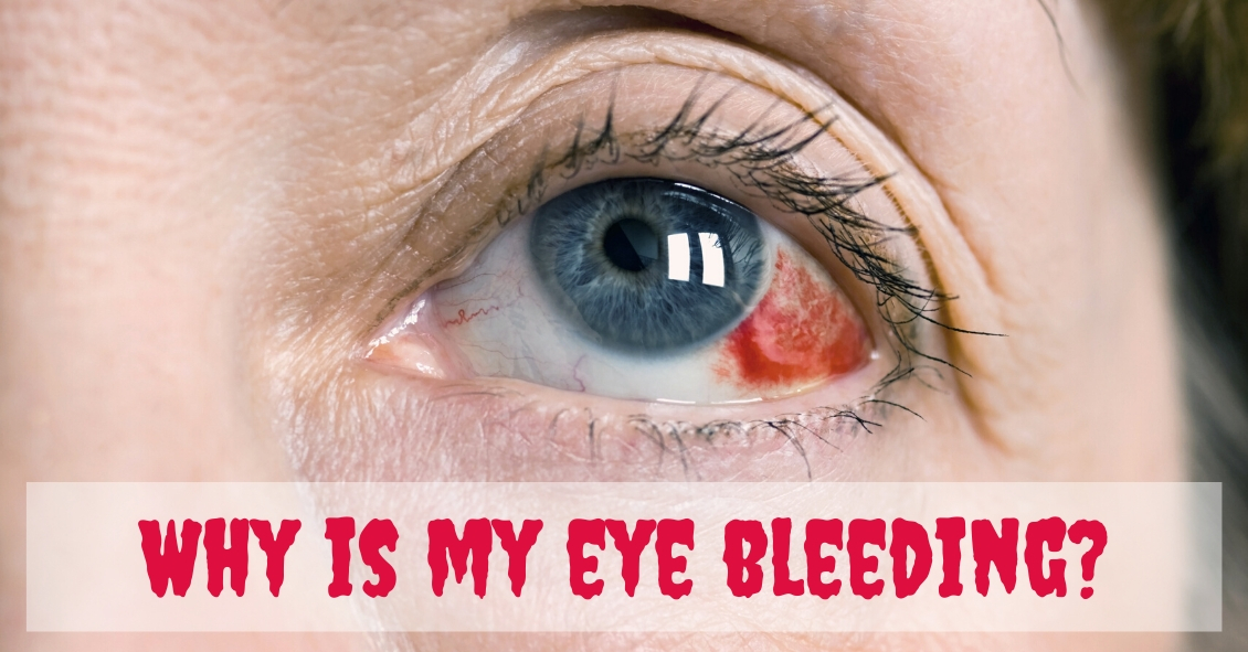 Is My Eye Bleeding Eye Doctor Optometrist Butler Grove City Pa