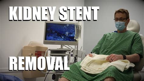 Kidney Stent Youtube