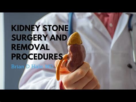 Kidney Stone Surgery Removal Procedures Dr Brian D Hale Youtube