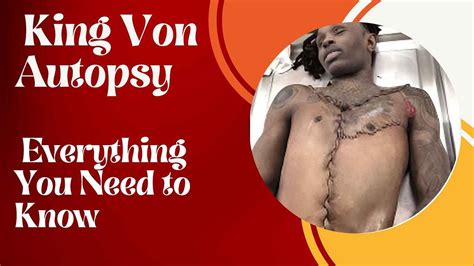 King Von Autopsy Report Graphic Photos And Cause Of Death