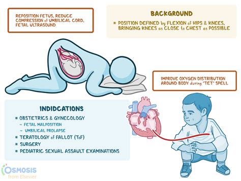 Knee To Chest Position