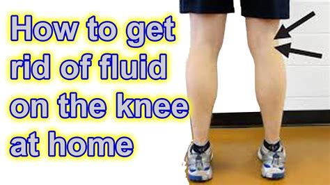 Kneecap Bump Treatment: Heal Faster