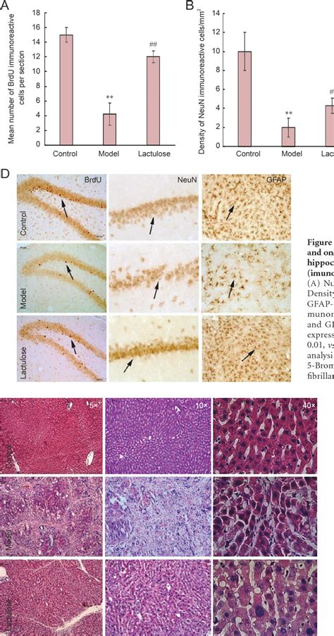 Lactulose Enhances Neuroplasticity To Improve Cognitive Function In