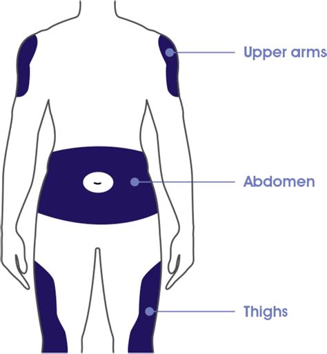 Lantus Insulin Injection Sites