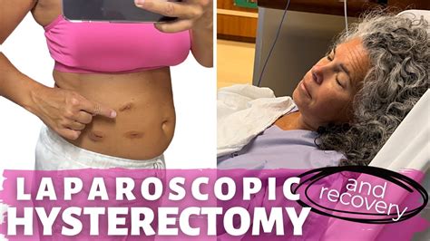 Lap Hysterectomy Recovery