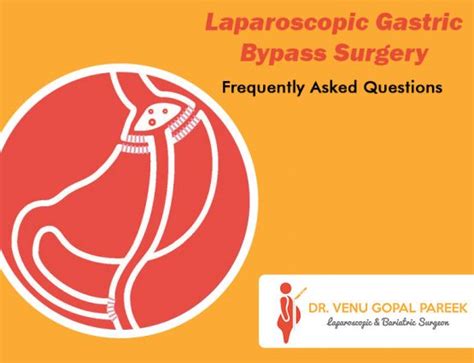 Laparoscopic Gastric Bypass Recovery Time Archives Dr V Pareek