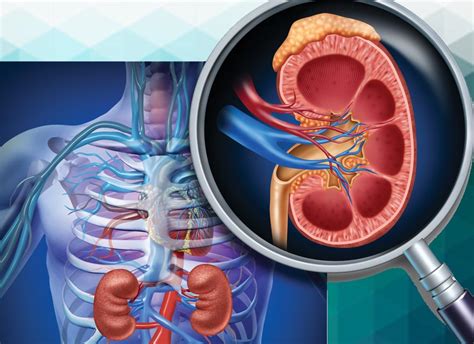 Laparoscopic Surgery Partial Kidney Nephrectomy Advanced Urology