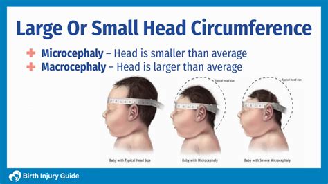 Large Or Small Head Circumference Birth Injury Guide