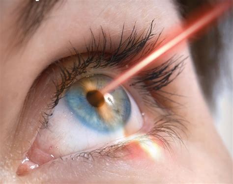 Laser Eye Treatment: Fast Recovery Tips