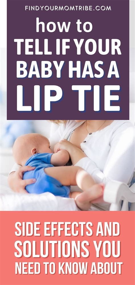 Lip Tie Relief: Symptoms & Solutions