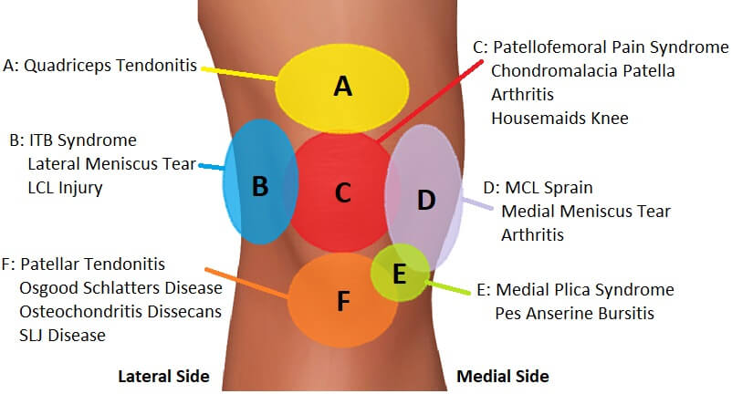 Lump Knee Cap: Relieve Pain Now