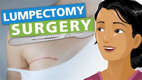 Lumpectomy Surgery Procedure Youtube