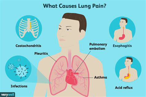 Lung Pain Causes Treatment And When To See A Healthcare Provider