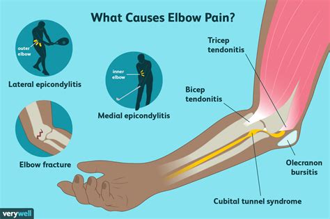 Lymph Nodes Elbow: Causes & Remedies