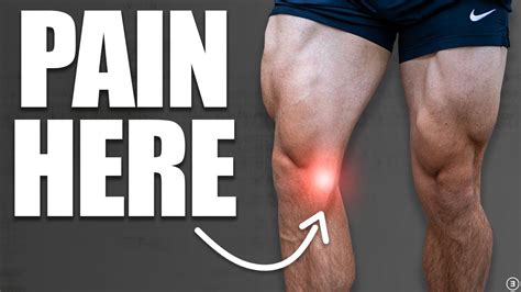 Mcl Strengthening: Relieve Knee Pain