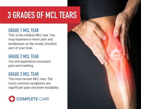 Mcl Tear Symptoms Diagnosis And Treatment