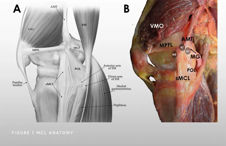 Mcl Tear Treatment Burr Ridge Plainfield Morris Il Mcl Surgery