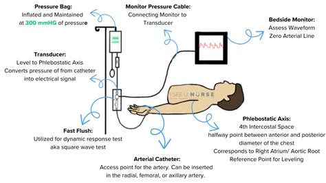 Medical A Line