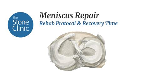 Meniscus Repair Protocol: Faster Healing