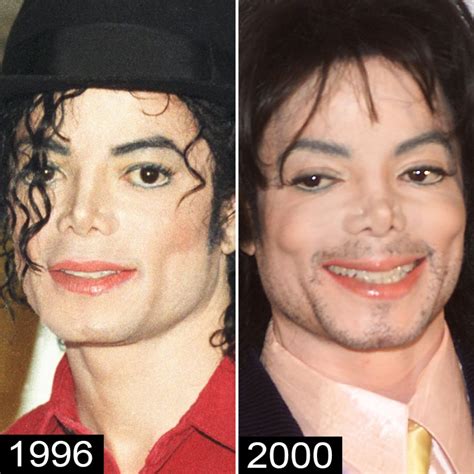 Michael Jackson S Plastic Surgery See His Transformation Life Style