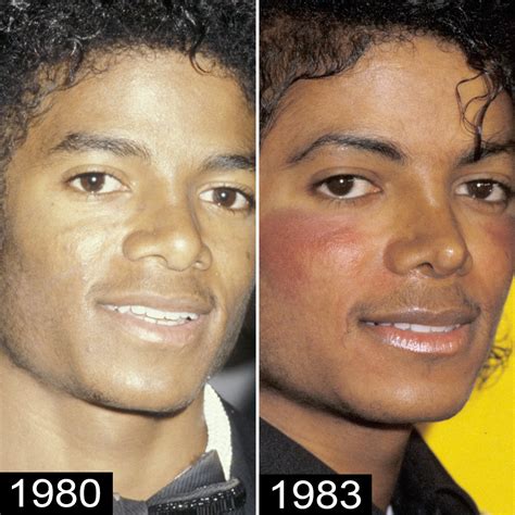 Michael Jackson S Plastic Surgery See His Transformation