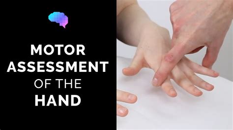 Motor Assessment Of The Hand Osce Guide Radial Ulnar Median