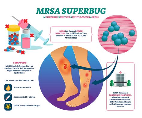 Mrsa